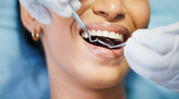 Best Broken or Chipped Tooth Repair in Metter, GA